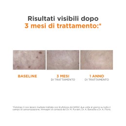 ISDIN Eryfotona AK-NMSC Fluid SPF 100+ - Previene e favorisce la riparazione del danno causato dal sole